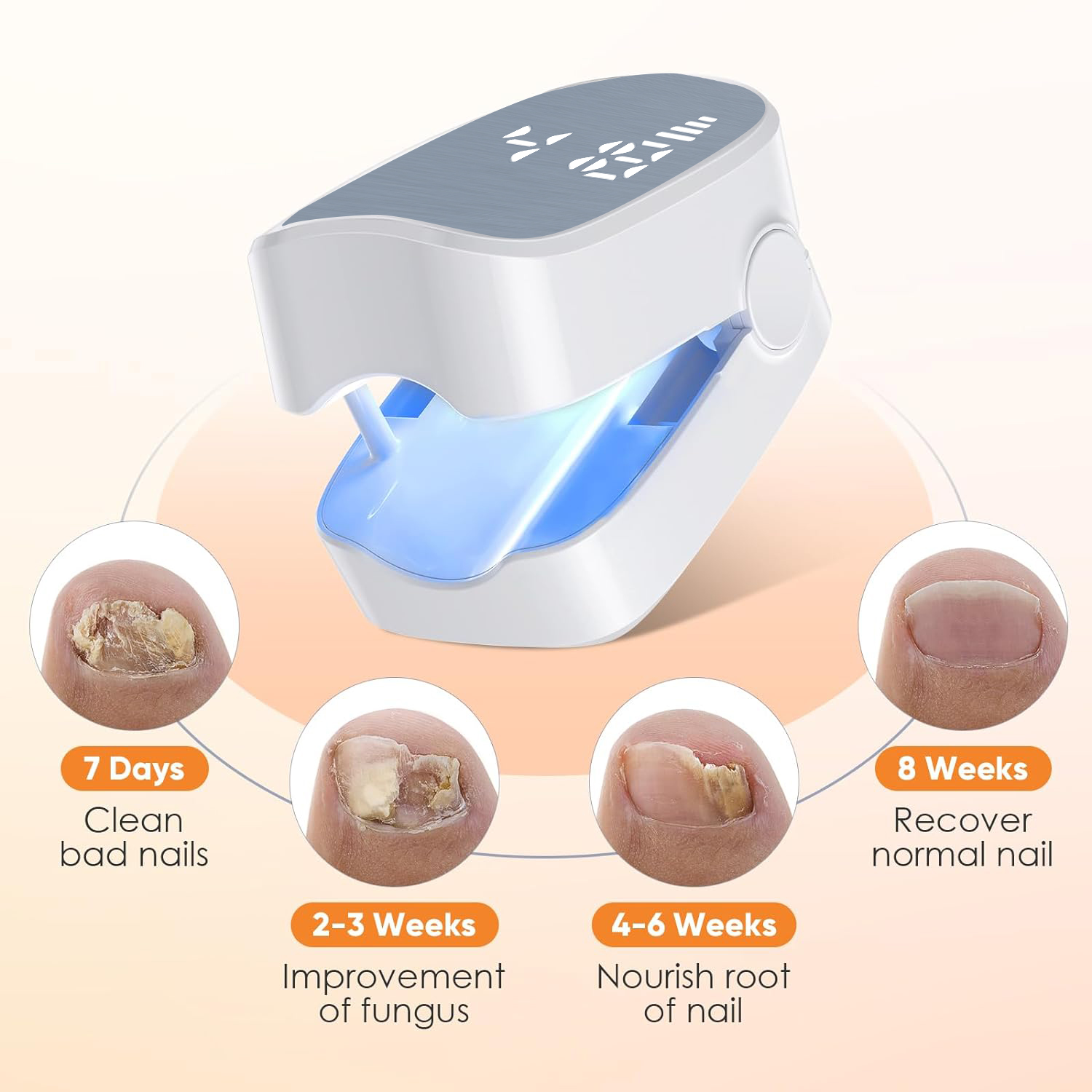 1 szt. Skuteczny akumulatorowy – Industrial Laser Removal recenzja i cena